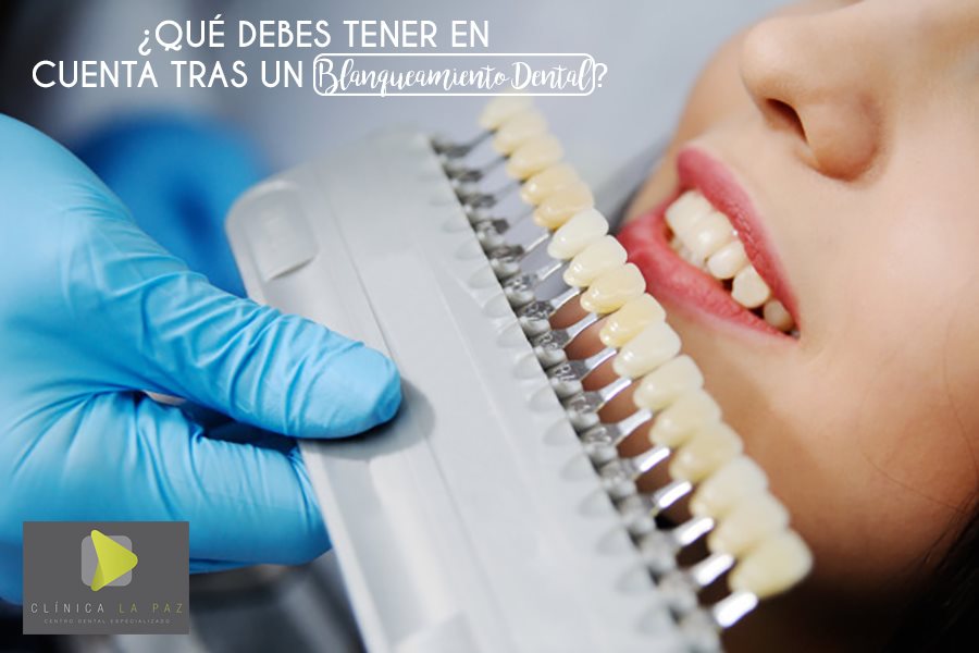 Blanqueamiento dental