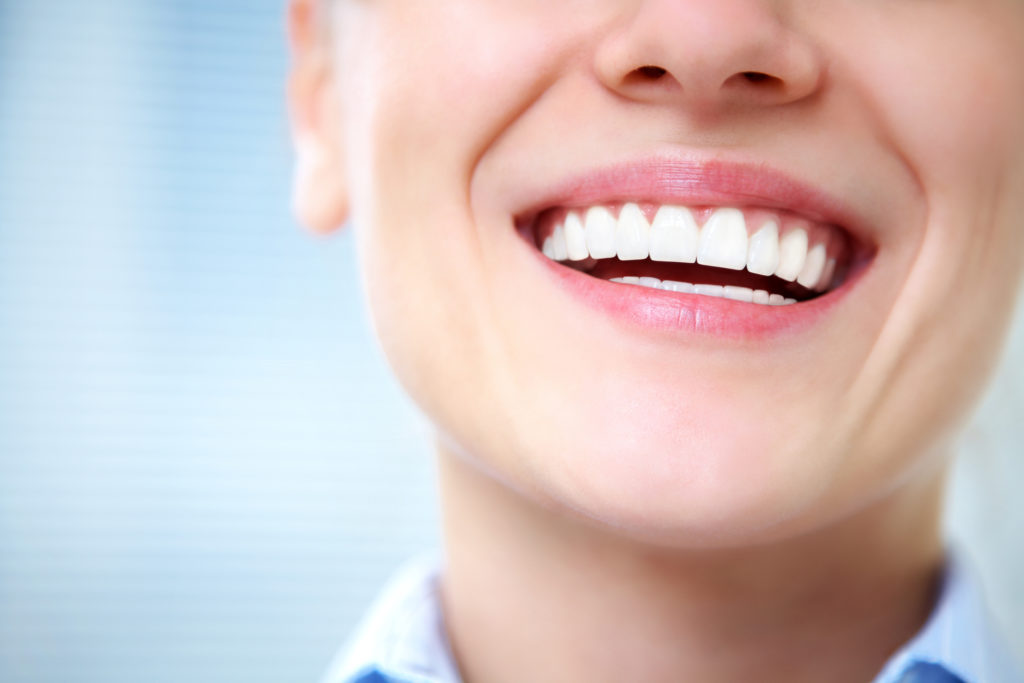 ¿Qué es la blancorexia y cómo puede afectar a tu sonrisa?
